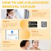 2026 Pore Vacuum with Camerafor, USB Rechargeable Blackhead Remover Vacuum,3 Levels Adjustable Pore Vacuum Blackhead Remover, 6 Suction Heads,Face Vacuum Pore Cleanser for Women & Men-White view 3