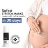 Th,ri.v.Co, Stretch Marks Expert Serum Cream | Clinically Proven Treatment for New (red) & Old (white) Stretch Marks & Scars Removal | Rosehip Oil & Squalane | For Women & Men | 30ml view 2
