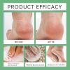 Herbal Foot Soak, Foot Bath Herb, Foot Spa Bath Soak Foot Detox Soak Foot Care Spa Relaxation view 3