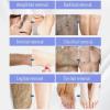 LYDIMOON Hair Removal Spray Sensitive Skin, for Women and Men, 5-Minute Hair Removal, Suitable For Bikini Line, Pubic Area, Legs, Arms And Underarms, 5 oz view 4