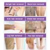 Hair Removal Spray for Women and Men,Painless Hair Removal Cream,For Unwanted Hair, All Skin Types,Bikini,Private Areas, Pubic, Body, Legs, and Underarms,soothing & Effective,Smooth Results,5oz (3) view 2