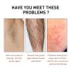 Hair Removal Spray for Women and Men,Painless Hair Removal Cream,For Unwanted Hair, All Skin Types,Bikini,Private Areas, Pubic, Body, Legs, and Underarms,soothing & Effective,Smooth Results,5oz (3) view 3