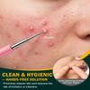 FVION Professional Acne Removal Needle  Dual-End Whitehead & Blackhead Remover, Pimple Extractor Tool for Face & Nose view 2
