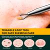 FVION Professional Acne Removal Needle  Dual-End Whitehead & Blackhead Remover, Pimple Extractor Tool for Face & Nose view 4