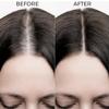 Brillarre's 20% Rosemary Oil Shots For Rapid Hair Growth | Improves Thickness | Controls Hair Fall & Nourishes Scalp | 100% Natural, Non Greasy Hair Oil Shots For Men & Women view 4