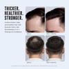 Hair Thickening & Anti Hair Loss Shampoo with DHT Blocker for Men's Hair Growth - 2-in-1 Anti Thinning Shampoo & Conditioner with Biotin, Saw Palmetto & Rosemary for Fuller Hair, Sulfate-Free, 10oz view 4