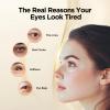 Abarno Hydrating Eye Serum for Dark Circles and Puffiness  Caffeine, Retinol, Niacinamide, Peptides  Anti-Wrinkle, Firming, Smooths Fine Lines  Under Eye Treatment  0.7 fl. oz view 2