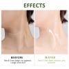 PEAQ SKIN, PEAQ Neck Firming Cream, PEAQ AH-8 Firming Lifting Neck Cream with Roller, Lifting Loose Skin, Smooths Wrinkles & Moisturizing Skin Care (3) view 4