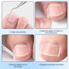 Professional Pedicure Tools Ingrown Toenail Treatment Kit, 4-Piece Set with Breathable Corrector Strips, Curved Patches, File and Lifter Tools for Preventive Care view 2