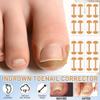 Professional Pedicure Tools Ingrown Toenail Treatment Kit, 4-Piece Set with Breathable Corrector Strips, Curved Patches, File and Lifter Tools for Preventive Care view 3
