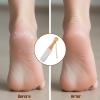 2 Pack Pumice Stone Foot File, Wooden Pedicure Foot Scrubber Feet Callus Remover for Dead Skin and Corns Pedicure Pumice Stone for Feet for Use in Shower Remove Corn Hard Skin view 3