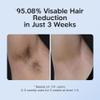 SIYACO Laser Hair Removal Device, 03 Heads at-Home IPL Hair Removal for Women & Men - Safe 45F Ice-Cooling Contact for Painless & Long-Lasting Results, 86% Hair Reduction in 3 Weeks for Full Body view 2