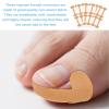 Ingrown Toenail Removal Set, Professional Ingrown Toenails Corrector Pedicure Tool with Strips Clippers File & Trimmer Nail Pedicure Tools for Home Use view 3