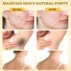2PCS Bee Venom Comprehensive Cream + Neck & Face Firming Cream | Dual Firming & Hydrating Anti-Aging Skincare Set view 4