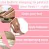 3 Pairs Aloe Socks Moisturizing Spa Socks for Cracked Feet Women Spa Lotion Sock, Sleeping Fuzzy Non-Slip Lotion Aloe Infused Sock for Women Foot Care for Repairing Softening Dry Cracked HEE view 3