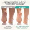 Callus Remover for Feet,Silicone Pedicure Tools Non-Slip Handle - Foot Scraper for Callus Removal - for Hard Cracked Heels Corns Wet Dry Peeling Men Women Seniors Home Travel Shower Bath view 4