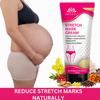 INTIIMIFY'S Stretch Mark Removal Cream for Women, Maternity Skin Care Lotion for Pregnancy & Postpartum, Reduces Marks & Scars  50g (Pack of 1) view 2