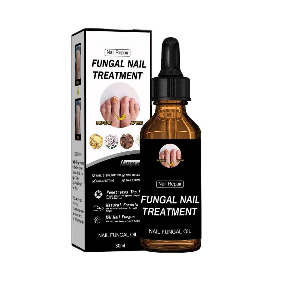 Nail Repair Essnce Liquid, Fingernail and Toenail Repair Fast, Gentle, Fix & Renew Damaged, Broken, Cracked & Discolored Nails, Reduce Nail Thickening, Strengthen Nails Beautiful