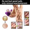 Nail Repair Essnce Liquid, Fingernail and Toenail Repair Fast, Gentle, Fix & Renew Damaged, Broken, Cracked & Discolored Nails, Reduce Nail Thickening, Strengthen Nails Beautiful view 4