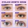 Lash Serum Natural & Vegan Eyelash Growth Serum for Longer, Thicker, Fuller Lashes Nourishing & Conditioning Formula Safe for Sensitive Eyes - 5ml view 3