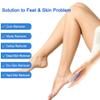 Toyvian 6pcs Natural Pumice Stone Foot Beauty Brush Double-Sided Pedicure Tool for Dead Skin Removal Callus Scraper Lightweight Portable Foot File Exfoliator Random Color view 3