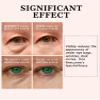 2 PCS Temporary Eye Tightener - Perfection Firming Lift Cream, Instant Eye Serum for Dark Circles & Puffiness, Daily Wrinkle Cream, Anti Aging Skin Care Treatment Women and Men, 1 oz view 3