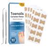 Ingrown Toenail Treatment, 50Pcs Ingrown Toenail Removal Kit with File and Lifter, Professional and Fast Acting view 1