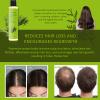 1PCSTgideasa Rosemary Hair Growth Shampoo,Upgraded New Tgideasa Organic Rosemary & Hydrolyzed Keratin Hair Growth Shampoo,Natural Anti-hair Loss shampoo for Women and Men,250ml/8.45floz (1PCS-A) view 4