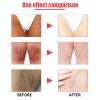 2026 new 50ml Crema Para Manchas Oscuras En La Cara Pink Privates Intimate Area cream crema Para Las Manchas De La Cara,Para Piel Entrepierna,Manchas Codos,Piernas Zonas,Rodillas Cuello (3pcs) view 4