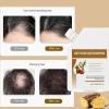 300ml Anti Hair Loss Shampoo,Anti-Hair Fall Promote Hair Growth,Rich in Various Plant Extracts,Volumizing and Moisturizing For All Types (3pcs) view 3