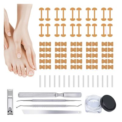 Ingrown Toenail Corrector Kit, Professional Nail Care Tools with Curved Correction Patches for Toe Pain Relief, Home Pedicure Solution(1 Set)