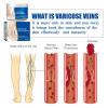 2 Pcs Varicose Veins Cream for Legs, SkinCream for Legs, Spider Varicose Veins ReliefCream, view 3
