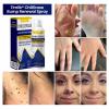 Luhaka Timilk Chill Erase Bump Renewal Spray, Soothing And Cooling Formula, Reduces Skin Imperfections, Absorbs Quickly, And Leaves No Residue (2PCS) view 3