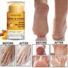 Amococo 2Pcs Foot Cream Set, Turmeric & Vitamin C, Natural Hydrating Heel Stick Balm,Deeply Moisturize Soften, Repair, Smoothens Dry Cracked Skin, Feet Care for Women and Men, 1.41 oz view 3