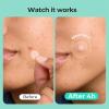 YIWMWIY Hydrocolloid Acne Patches for Face & Nose, 49-Count Contoured Pimple Patches with Moon, Nose & XL Square Shapes view 3