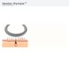 Varelon Olympia 100% Stainless Steel Facial Hair Remover Spring  Manual Coil Epilator for Upper Lip, Chin & Cheeks  PlasticFree, Reusable, Easy to Sanitize  Portable view 4