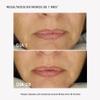 MASDERM - RF Facial Cream 1000 ml, Moisturizing Conductive Cream for Radio Frequency and Microcurrent Devices, Professional and Home Use, Hydrating, Firming, and Smoothing Cream for Face and Neck view 4