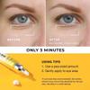 DERPHEA Instant Under-Eye-bag Tightening Cream: Temporary Eye Bags Tightener and Remover for Men & Women 50+ - Rapid Eye Puffiness Reducer, Wrinkle Smoothing & Lifting, Firming Treatment Cream, 0.5 oz view 3