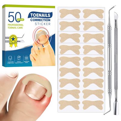 Ingrown Toenail Treatment, 50Pcs Breathable Ingrown Toenail Corrector Patches with Nail File & Lifter, Professional-Grade Treatment for Fast Results