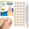Ingrown Toenail Treatment, 50Pcs Breathable Ingrown Toenail Corrector Patches with Nail File & Lifter, Professional-Grade Treatment for Fast Results view 1