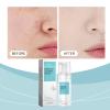 Aeviani Amino Acid Cleansing Mousse, Gentle Face Wash with Centella Asiatica and Lilium Candidum Extract, Moisturizing Facial Cleanser, 120ML/4FL.OZ view 3