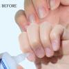 SASSYTIP Dynamic Duo: 15-Second Cuticle Remover Gel + Strengthening Nail Oil Pen. Get Salon-Perfect Nails at Home! Save with This Bundle. (Gel+Lemon) view 2