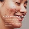 Cystic Acne Lotion + Fungal Acne Lotion + Body Acne Scrub  3-Step Breakout & Texture Care System for Face, Body, and Acne-Prone Areas  Helps Improve Bumps, Redness & Uneven Texture view 2