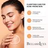 Cystic Acne Lotion + Fungal Acne Lotion + Body Acne Scrub  3-Step Breakout & Texture Care System for Face, Body, and Acne-Prone Areas  Helps Improve Bumps, Redness & Uneven Texture view 4