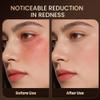 Red Light Therapy Mask for Face with 4 Modes Adjustable Timer view 4