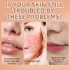 2PCS Hair Removal Cream Gently Softens Facial Hair Follicles Effortlessly Removes Fine Facial Hair Skin-Smoothing Lotion view 4