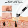 Blackhead Remover Pore Vacuum, Pore Cleaner for Face with 5 Attachments & 3 Suction Levels, USB Rechargeable Facial Blackhead Extractor Tool for Women & Men (Pearl White) view 3