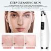 Blackhead Remover Pore Vacuum, Pore Cleaner for Face with 5 Attachments & 3 Suction Levels, USB Rechargeable Facial Blackhead Extractor Tool for Women & Men (Pearl White) view 4