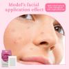 Evyra Spotless Patch Invisible Hydrocolloid Blemish Cover Dots Ultra-Thin, Clear Spot Stickers for Discreet Coverage 72 Count view 3
