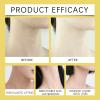 Neck Lifting Strips for Moisturizing, Firming, Smoothing and Daily Neck Skin Care with Gentle Adhesive view 4